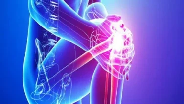 Artrosis: evite la trampa de los analgesicos