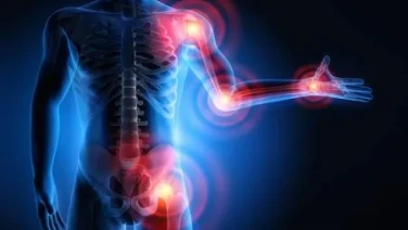 El harpagofito tiene unos potentes efectos antiinflamatorios