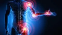 El harpagofito tiene unos potentes efectos antiinflamatorios